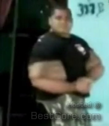 Synthol Arm Explode / Open Muscle Rupture