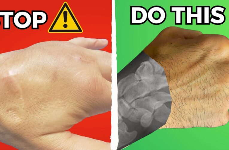 The Ultimate Guide to Punch Bare-Knuckle